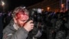 Раненный во время столкновений со спецназом фотограф Глеб Гаранич